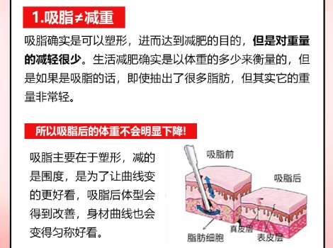 郑州吸脂专家排名靠前的有孟宝玺|罗明生|郭雅昆等医生资历深厚!插图4 郑州吸脂专家排名靠前的有孟宝玺|罗明生|郭雅昆等医生资历深厚!插图4