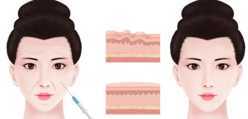 聂婕医生口碑怎么样?医生实力点评|擅长项目|价格表发布!插图4 聂婕医生口碑怎么样?医生实力点评|擅长项目|价格表发布!插图4
