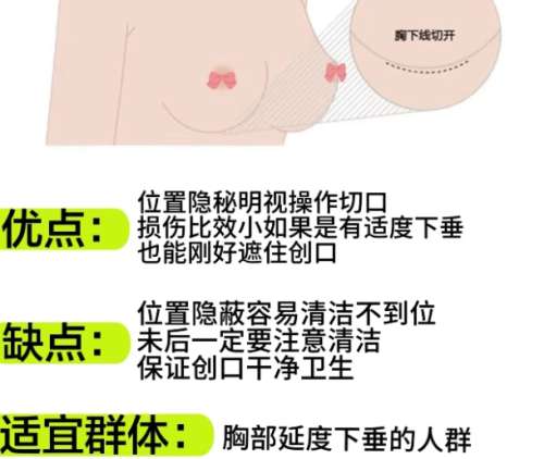 佛山丰胸医生排名！医生项目亮点介绍插图4