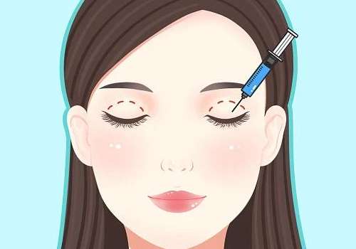 成都何莎双眼皮口碑怎么样?真实反馈+4年经验、术后自然没有痕迹插图 成都何莎双眼皮口碑怎么样?真实反馈+4年经验、术后自然没有痕迹插图