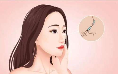 项昌峰鼻修复怎么样?坐诊医院是哪家?鼻修复按比例插图2 项昌峰鼻修复怎么样?坐诊医院是哪家?鼻修复按比例插图2