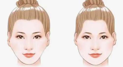 张笑天磨骨技术怎么样?医生简介|真人磨骨案例分析插图3 张笑天磨骨技术怎么样?医生简介|真人磨骨案例分析插图3