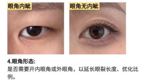 济南双眼皮医生排名!医生坐诊医院介绍!收藏再看!插图4 济南双眼皮医生排名!医生坐诊医院介绍!收藏再看!插图4