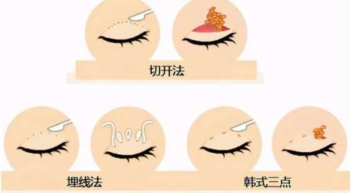 重庆铜雀台做眼睛好的医生都有谁？郑楠、廖雪梅凭实力上榜！插图3