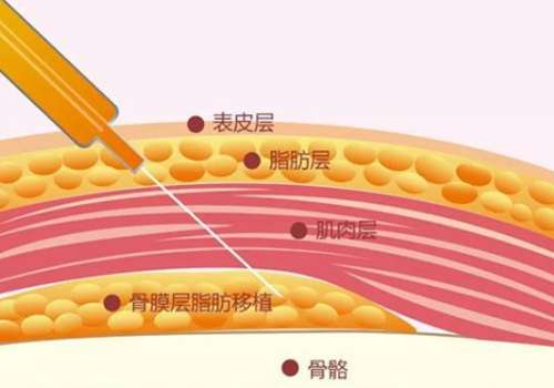 程开祥医生是正规医生吗?上海九院副主任医师、擅长自体脂肪增粗术插图1 程开祥医生是正规医生吗?上海九院副主任医师、擅长自体脂肪增粗术插图1