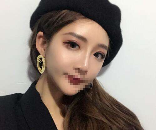 戚昌栋双眼皮修复的好吗?技术怎么样?个人资料、坐诊机构展示插图3 戚昌栋双眼皮修复的好吗?技术怎么样?个人资料、坐诊机构展示插图3