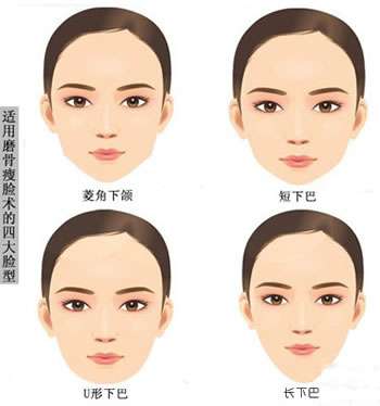 南京下颌角手术都有哪些专家?于攀、沈干等5大口碑医生测评插图 南京下颌角手术都有哪些专家?于攀、沈干等5大口碑医生测评插图