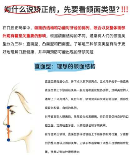 青岛颌面外科医生!医生技术解析及案例鉴赏!面诊前必看!插图4 青岛颌面外科医生!医生技术解析及案例鉴赏!面诊前必看!插图4