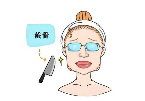 北京圣嘉荣黄大勇磨骨资料更新！医生口碑解析、真实案例分享插图2
