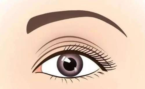 杭州甄美做双眼皮怎么样?孙超vs周彩红谁的技术好?案例分析插图4 杭州甄美做双眼皮怎么样?孙超vs周彩红谁的技术好?案例分析插图4