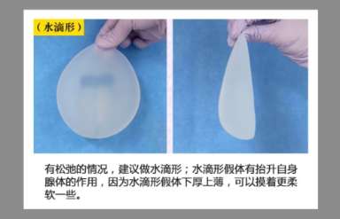 哈尔滨隆胸医生排行榜推荐！医生名单详细介绍插图4