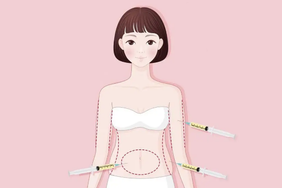 南京背部吸脂减肥需要注意些什么呢？有没有风险插图