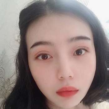 黄金龙医生双眼皮案例,术后和小眼睛差别很大,真的是水汪汪!插图3 黄金龙医生双眼皮案例,术后和小眼睛差别很大,真的是水汪汪!插图3