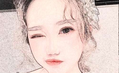 南方医科大学南方医院廖云君疤痕整形技术怎么样?价格多少?真实案例分析插图2 南方医科大学南方医院廖云君疤痕整形技术怎么样?价格多少?真实案例分析插图2