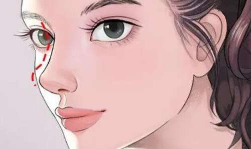 长沙希美肖阳医生口碑怎么样?医生实力测评|隆鼻案例分析插图4 长沙希美肖阳医生口碑怎么样?医生实力测评|隆鼻案例分析插图4