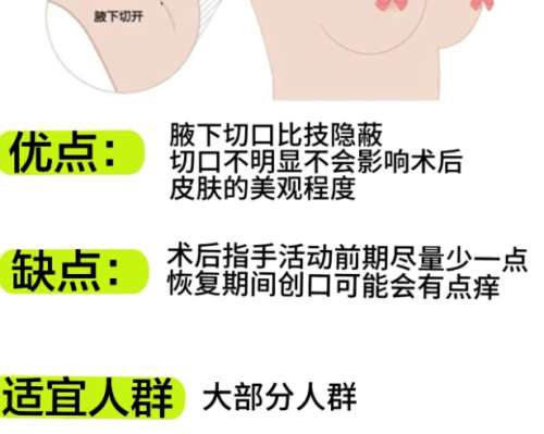 无锡隆胸医生排名推荐!医生个人资料简介!速速码住!插图4 无锡隆胸医生排名推荐!医生个人资料简介!速速码住!插图4