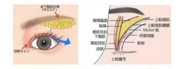 长沙双眼皮修复的名医排名!院内实力医生简介!插图4 长沙双眼皮修复的名医排名!院内实力医生简介!插图4