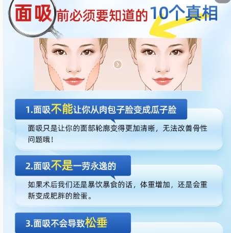 杭州面吸医生厉害医生都有谁?易成刚、胡学庆实力强劲插图4 杭州面吸医生厉害医生都有谁?易成刚、胡学庆实力强劲插图4