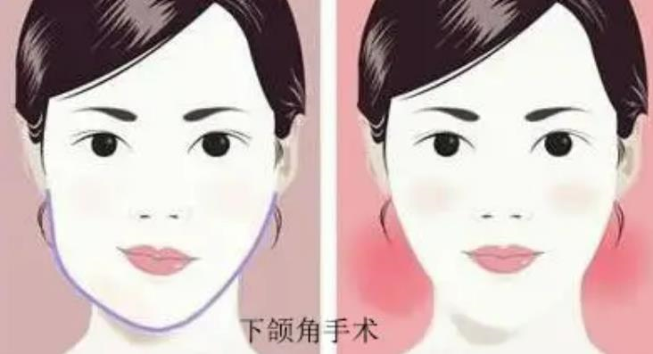 中国航天731医院整形怎么样达人干货分享~插图1