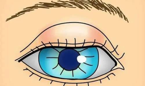 深圳黄海侠做眼睛怎么样?技术靠谱吗?来看详细介绍!插图3 深圳黄海侠做眼睛怎么样?技术靠谱吗?来看详细介绍!插图3