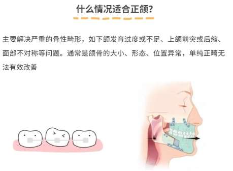 济南颌面外科厉害的三个医生有哪些？口碑良好，案例分析插图4