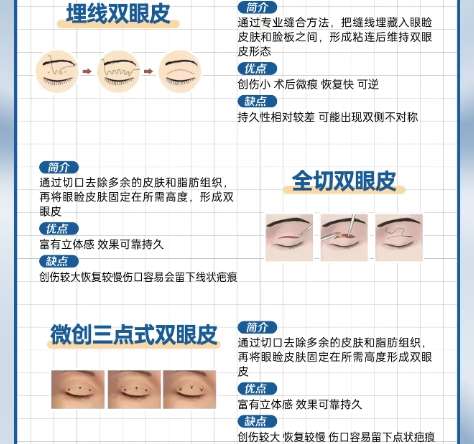 贵阳双眼皮手术医生排名情况!医生经验丰富技术实力较好插图4 贵阳双眼皮手术医生排名情况!医生经验丰富技术实力较好插图4