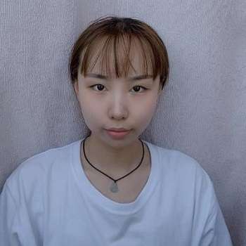 倪景辉做双眼皮好吗?医生简介、技术优势、坐诊机构、案例插图2 倪景辉做双眼皮好吗?医生简介、技术优势、坐诊机构、案例插图2