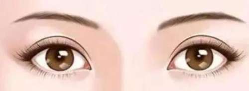 太原欧美莲于永红双眼皮技术怎么样？网友真实评价来袭！插图3