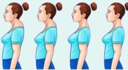 马晓荣医生的口碑怎么样？双眼皮、去眼袋技术点评！插图2