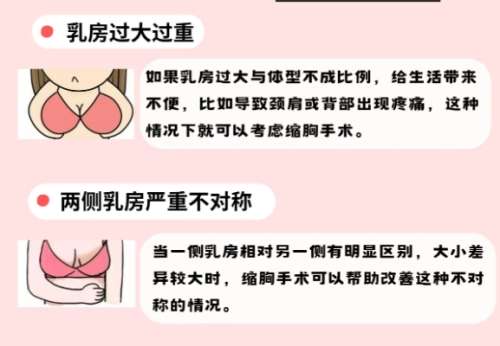 浙一医院假体隆胸多少钱?价格信息盘点来袭!医生信息分析插图2 浙一医院假体隆胸多少钱?价格信息盘点来袭!医生信息分析插图2