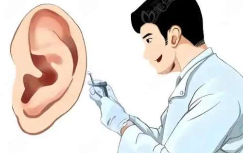 北京八大处章庆国医生口碑怎么样做耳朵？贴发耳矫正2万6左右！插图3