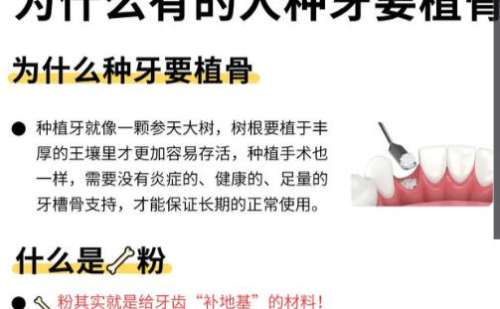 金华市中心医院种植牙一颗多少钱?价格低至3k起技术精湛!插图3 金华市中心医院种植牙一颗多少钱?价格低至3k起技术精湛!插图3