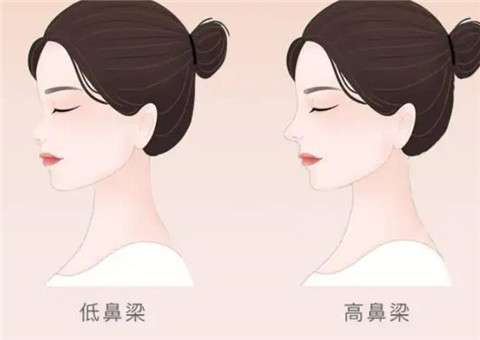 李国珍医生做鼻子做的怎么样？坐诊上海美丽之星！价格公道！插图1
