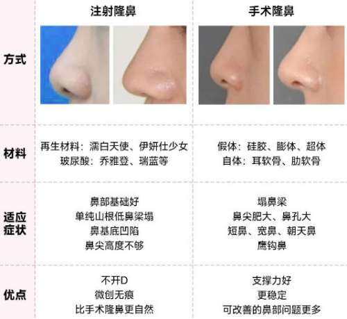 上海九院钱云良怎么样？技术、擅长项目盘点！隆鼻/隆胸口碑盘点！插图1