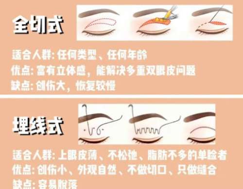 冷向锋医生擅长什么手术？双眼皮、祛眼袋项目介绍！插图1