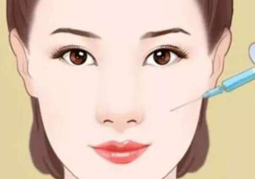 蹇洪苹果肌复位多少钱?插图4 蹇洪苹果肌复位多少钱?插图4