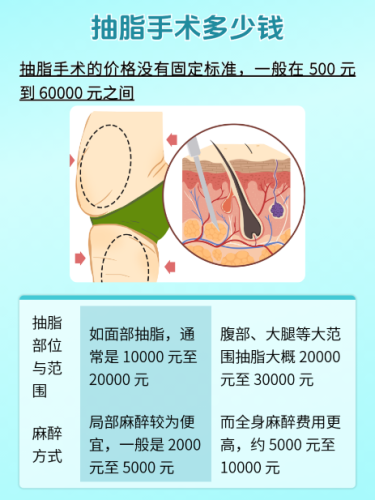 上海第十人民医院抽脂多少钱？2026最新价格表+真实案例，透明收费不踩坑插图