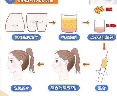 王连召出诊时间挂号流程详细介绍！含术后注意事项速速来看插图2