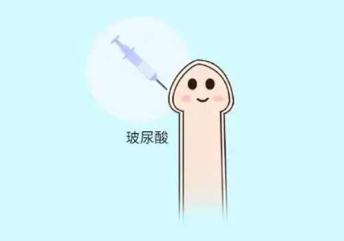 北京大学第一医院玻尿酸男性增大注射要多少钱？起步价大概8千元起插图