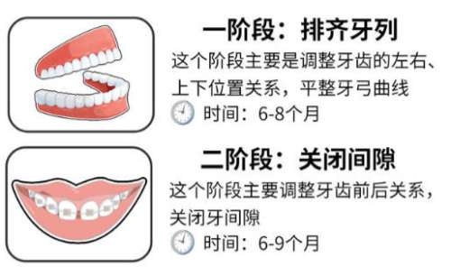 西安牙齿矫正价格价格怎么样?价格在8k至3w不等!等你分析!插图1 西安牙齿矫正价格价格怎么样?价格在8k至3w不等!等你分析!插图1