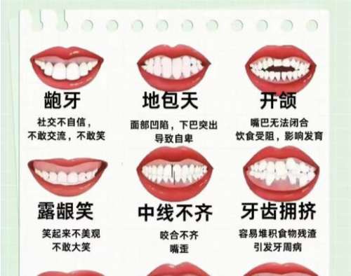 东莞牙齿矫正价格表新鲜出炉!有三家实力靠谱的医院!插图 东莞牙齿矫正价格表新鲜出炉!有三家实力靠谱的医院!插图