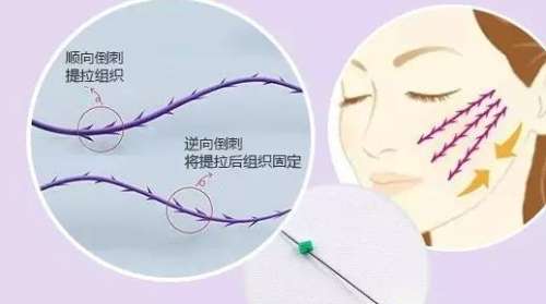 北京于晓春线雕价格表2026更新，轮廓固定价格1.5万元-2.9万元不等插图