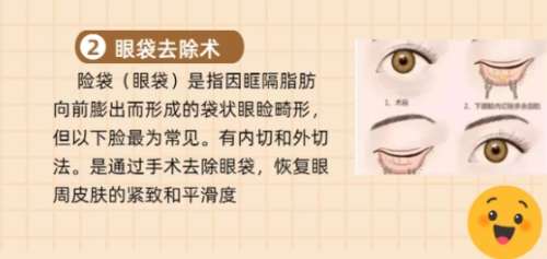 北京301医院祛眼袋需要多少钱?戳进来看具体相关介绍!插图 北京301医院祛眼袋需要多少钱?戳进来看具体相关介绍!插图