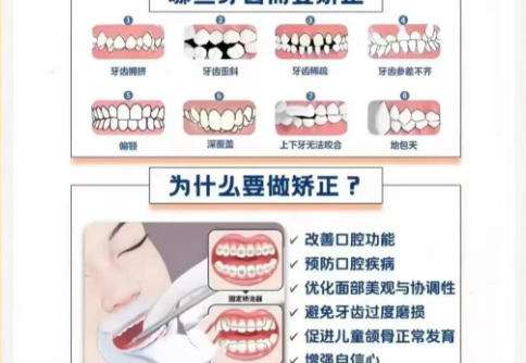 李逸松医生怎么预约？附真实术后口碑供您参考！速速收藏插图2