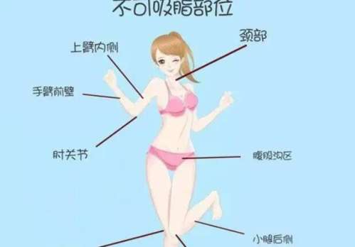 广州华美吸脂吸脂张思华主任怎么样？插图3