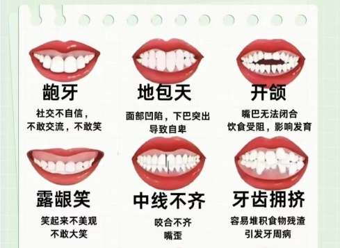 福州地包天矫正需要多少钱?推荐几家口碑好实力强的医院!插图1 福州地包天矫正需要多少钱?推荐几家口碑好实力强的医院!插图1