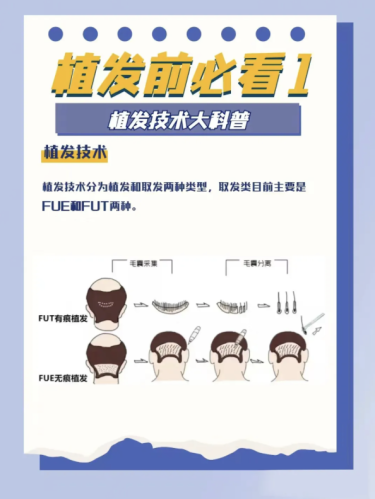 台州医院植发价格大揭秘！2026最新价格表+3个真实案例，省钱避坑看这篇就够了插图
