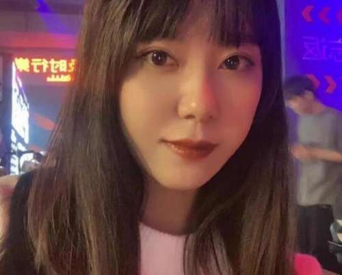 高一生张林宏医生双眼皮手术案例，技术与审美的绝佳配合插图2