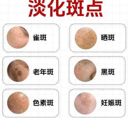 八大处霍孟华光子嫩肤案例图展示！做嫩肤技术口碑好！2026价格速查插图