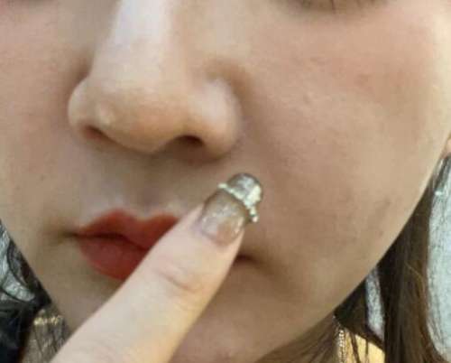 陈小平鼻基底案例，精致美鼻轻松打造插图1